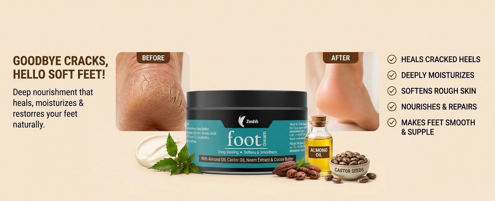 Zeshh Foot Cream for cracked heels and dry feet with almond oil, castor oil, and neem extract to deeply moisturize, repair rough skin, and soften feet.