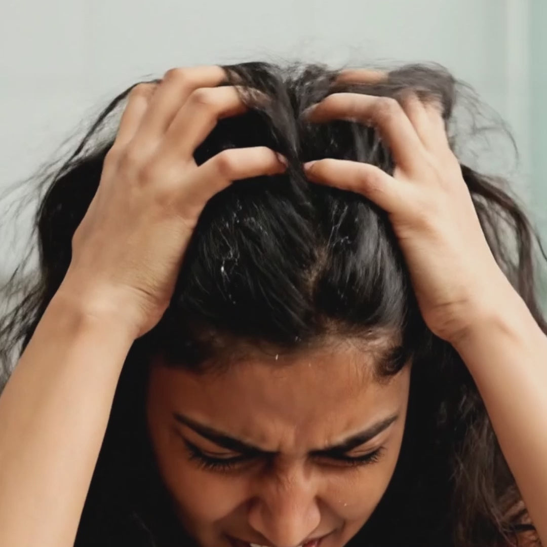 Dandruff Shampoo controls flakes & soothes itchy scalp